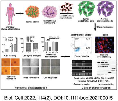 Human breast tumor derived endothelial cells exhibit distinct biological properties