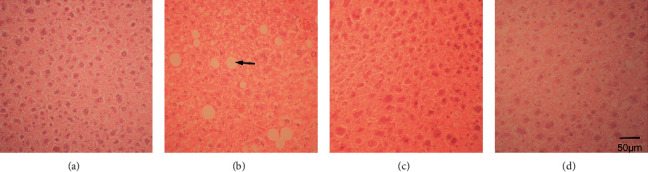 Reaction of the Liver upon Long-Term Treatment of Fluoxetine and Atorvastatin Compared with Alcohol in a Mouse Model.