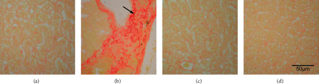 Reaction of the Liver upon Long-Term Treatment of Fluoxetine and Atorvastatin Compared with Alcohol in a Mouse Model.