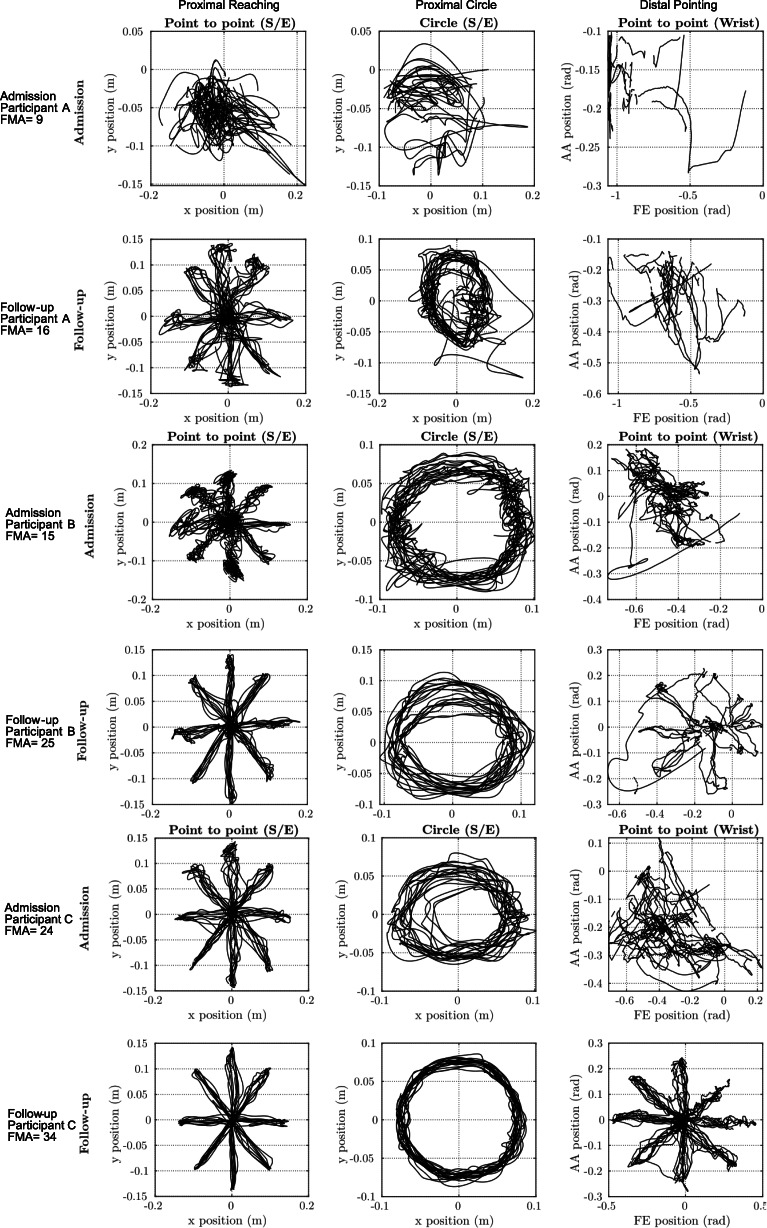 Robotic Kinematic measures of the arm in chronic Stroke: part 2 - strong correlation with clinical outcome measures.