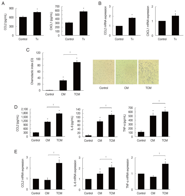 Involvement of Macrophages in Proliferation of Prostate Cancer Cells Infected with Trichomonas vaginalis.