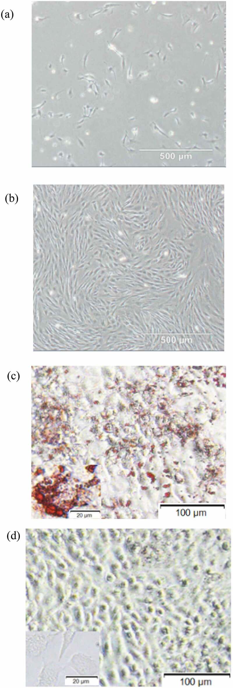 MicroRNA-378 regulates adipogenic differentiation in bovine intramuscular preadipocytes by targeting <i>CaMKK2</i>.