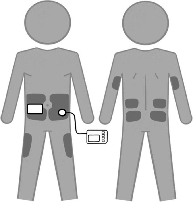 Practical aspects of diabetes technology use: Continuous glucose monitors, insulin pumps, and automated insulin delivery systems