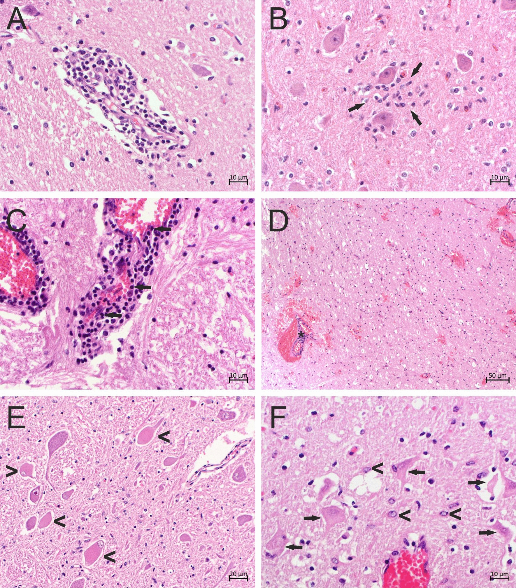 A novel Betaretrovirus discovered in cattle with neurological disease and encephalitis.