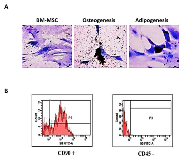 BM-MSC-derived small extracellular vesicles (sEV) from trained animals presented nephroprotective potential in unilateralureteral obstruction model.