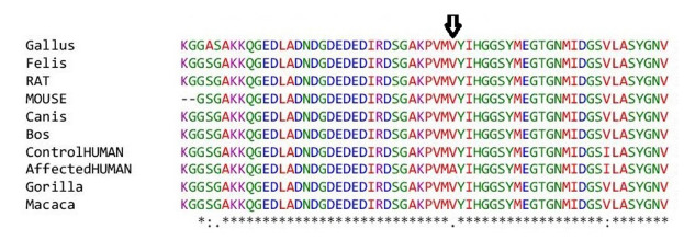 Genetic analysis of the postsynaptic transmembrane X-linked neuroligin 3 gene in autism.