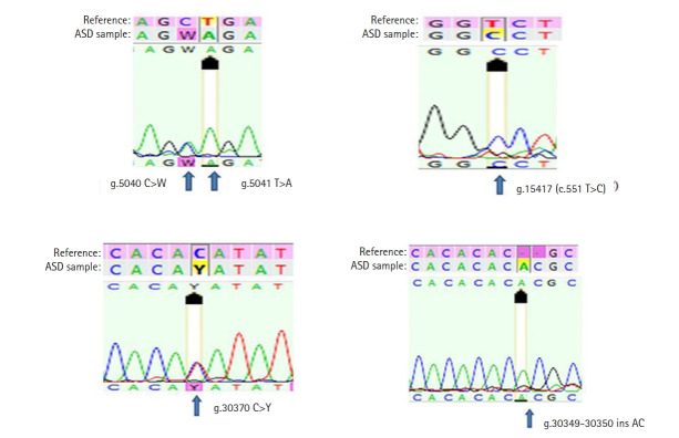 Genetic analysis of the postsynaptic transmembrane X-linked neuroligin 3 gene in autism.