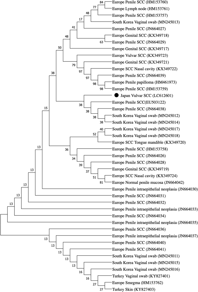 Vulvar squamous cell carcinoma associated with Equus caballus papillomavirus type 2 infection in a Japanese mare