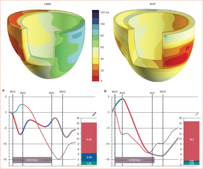 Electro-energetics of Biventricular, Septal and Conduction System Pacing.