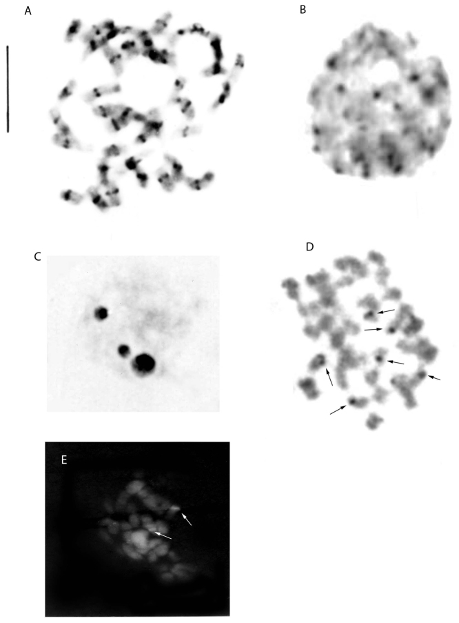 ﻿Comparative chromosome studies in species of subtribe Orchidinae (Orchidaceae).