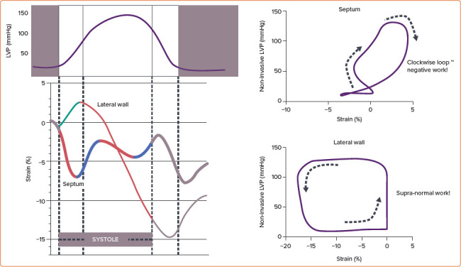 Electro-energetics of Biventricular, Septal and Conduction System Pacing.