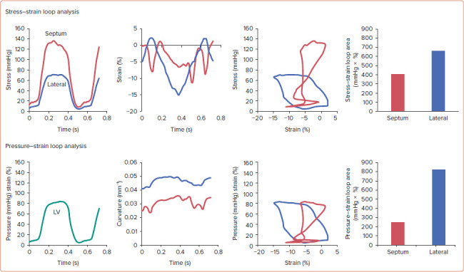 Electro-energetics of Biventricular, Septal and Conduction System Pacing.