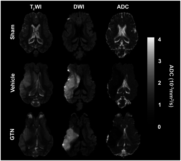 Glyceryl trinitrate for the treatment of ischaemic stroke: Determining efficacy in rodent and ovine species for enhanced clinical translation.