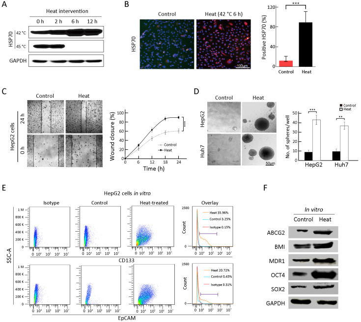 All-trans retinoic acid (ATRA) inhibits insufficient radiofrequency ablation (IRFA)-induced enrichment of tumor-initiating cells in hepatocellular carcinoma.