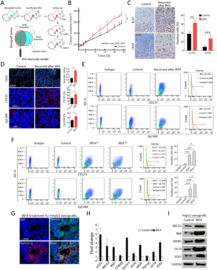 All-trans retinoic acid (ATRA) inhibits insufficient radiofrequency ablation (IRFA)-induced enrichment of tumor-initiating cells in hepatocellular carcinoma.