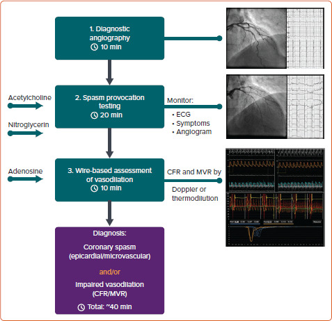 Definitions and Epidemiology of Coronary Functional Abnormalities.