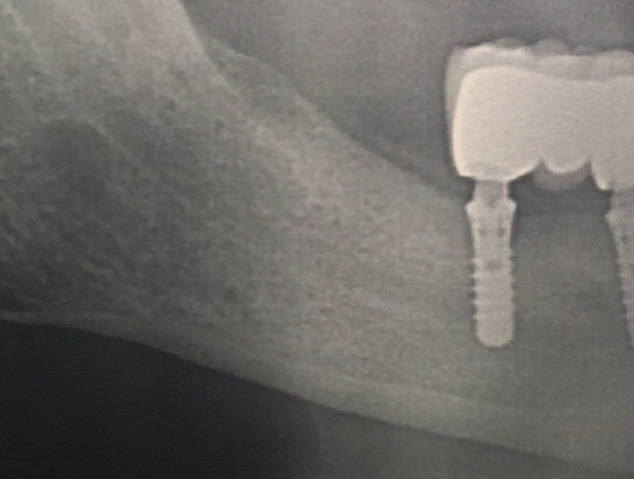 Trigeminal nerve injuries. Four years' experience at a single Argentine referral center and a literature review.