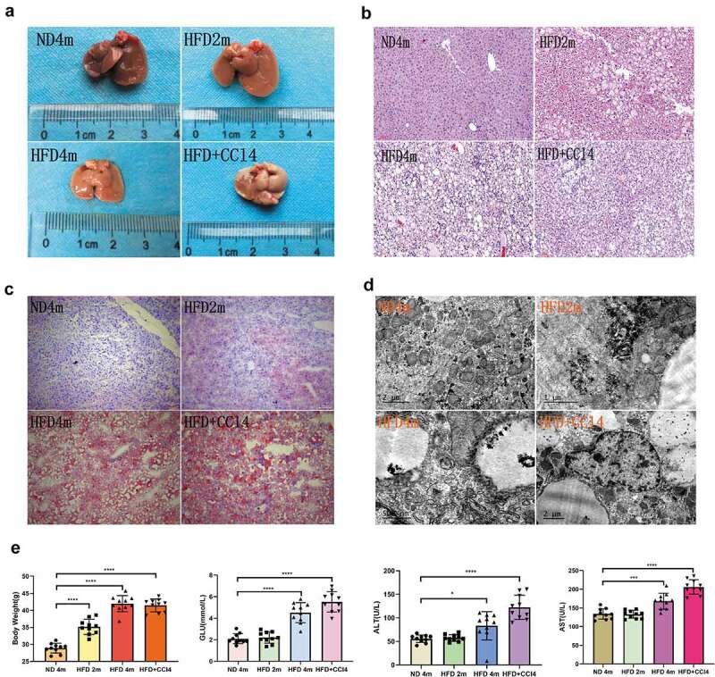 Verapamil induces autophagy to improve liver regeneration in non-alcoholic fatty liver mice.