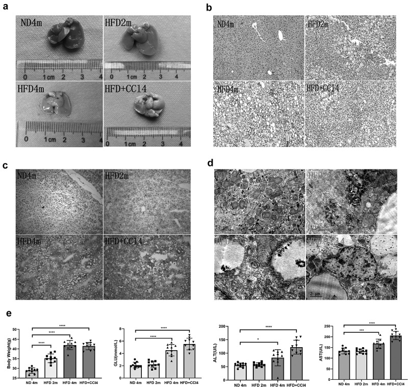 Verapamil induces autophagy to improve liver regeneration in non-alcoholic fatty liver mice.