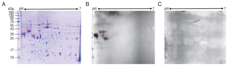 Proteomic and Immunological Identification of Diagnostic Antigens from Spirometra erinaceieuropaei Plerocercoid.