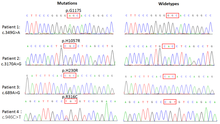 Evaluation of <i>MYRF</i> as a candidate gene for primary angle closure glaucoma.