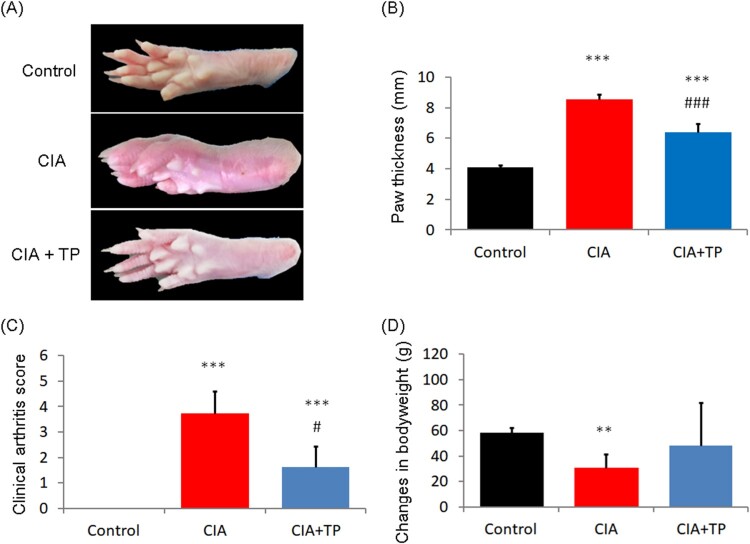 The antioxidant effect of triptolide contributes to the therapy in a collagen-induced arthritis rat model.