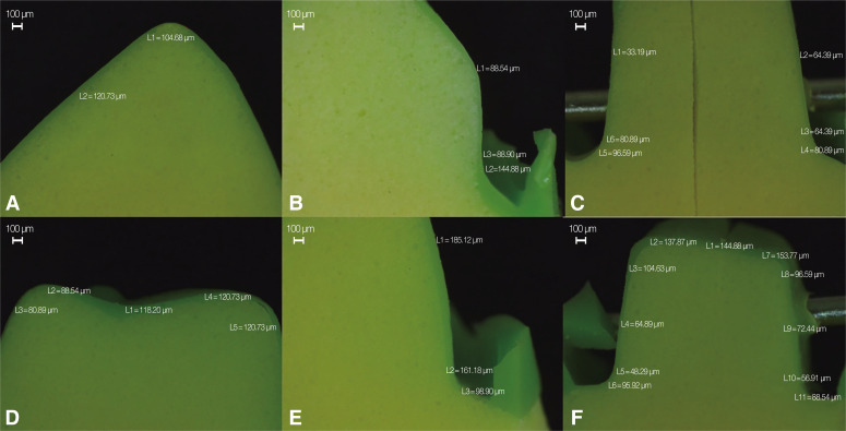 <i>In-vitro</i> evaluation of marginal and internal fit of 3-unit monolithic zirconia restorations fabricated using digital scanning technologies.