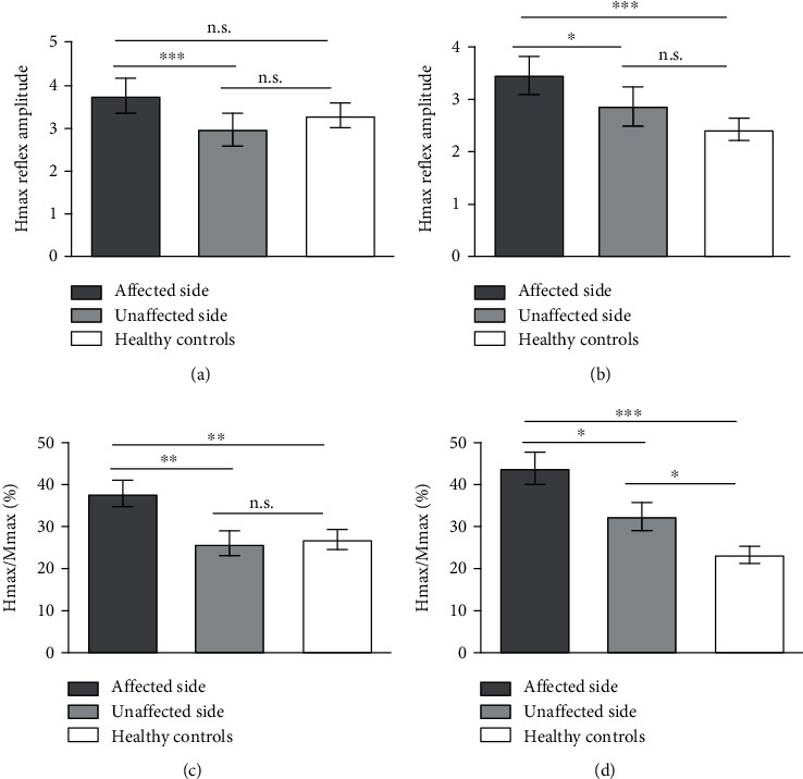 Soleus H-Reflex Change in Poststroke Spasticity: Modulation due to Body Position.