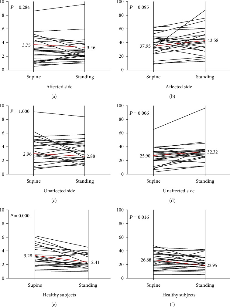 Soleus H-Reflex Change in Poststroke Spasticity: Modulation due to Body Position.