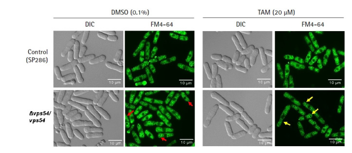 Knockdown of vps54 aggravates tamoxifen-induced cytotoxicity in fission yeast.