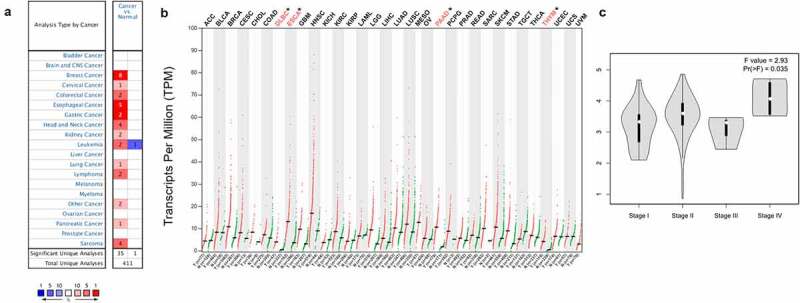 PANX1 is a potential prognostic biomarker associated with immune infiltration in pancreatic adenocarcinoma: A pan-cancer analysis.