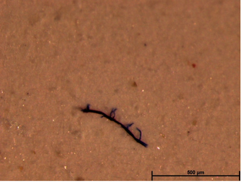 Occurrence of potential plastic microfibers in mussels and anchovies sold for human consumption: Preliminary results.