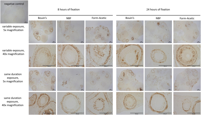 Fixation in Form-Acetic allows hyaluronic acid detection in mouse ovaries.