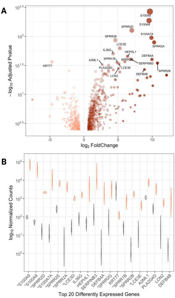 Evolutionary context of psoriatic immune skin response.