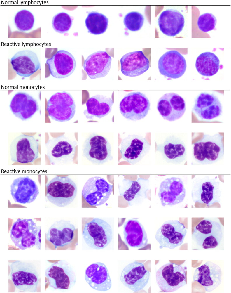 The importance of manual white blood cell differential counts and platelet estimates in elephant hematology: blood film review is essential.