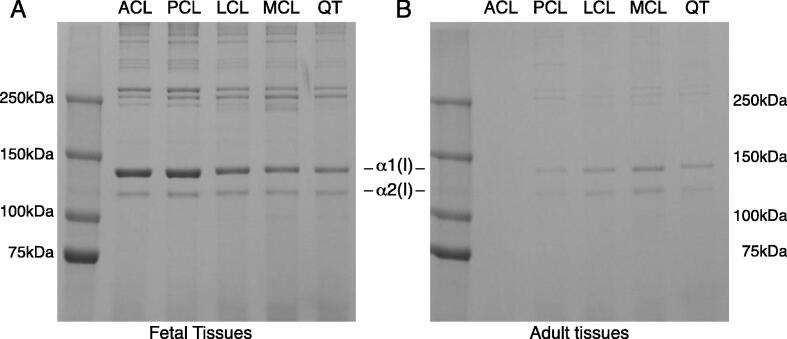 Age-related type I collagen modifications reveal tissue-defining differences between ligament and tendon