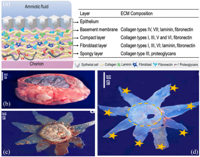 Use of biomaterials in corneal endothelial repair.