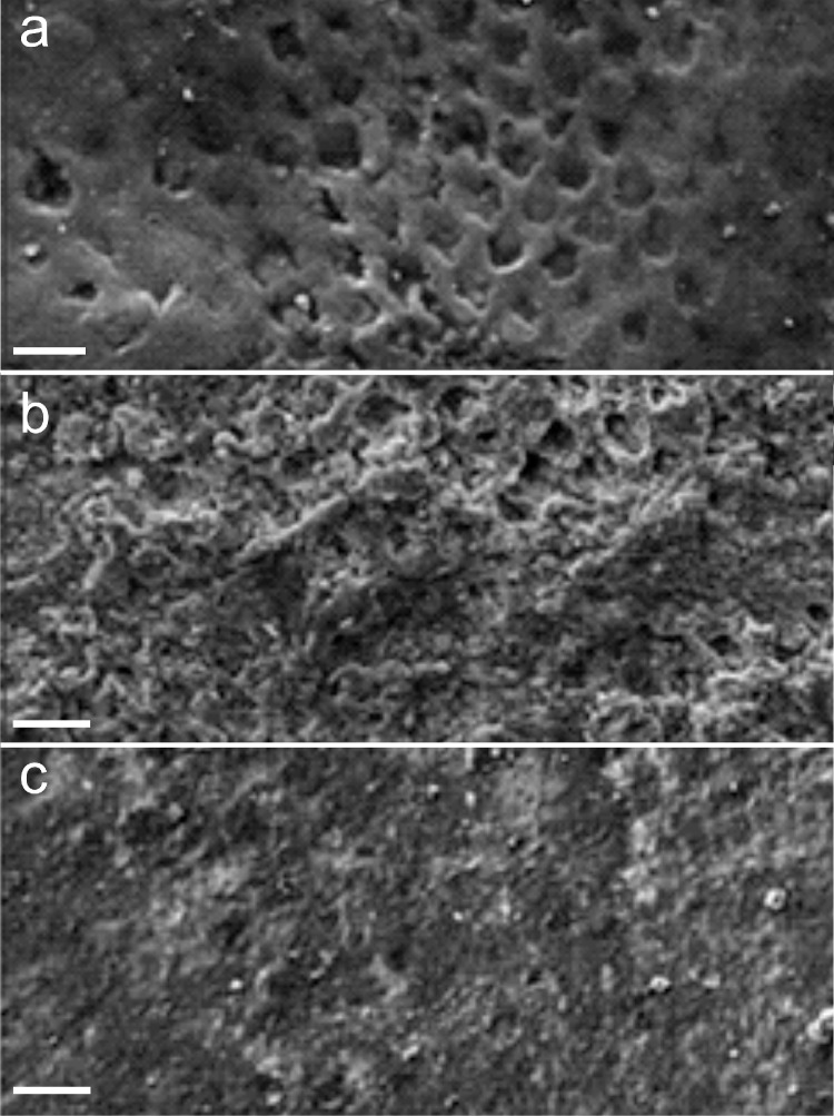 Advanced non-fluoride approaches to dental enamel remineralization: The next level in enamel repair management