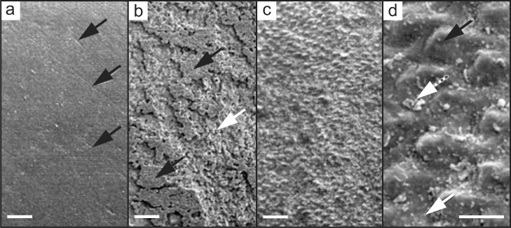 Advanced non-fluoride approaches to dental enamel remineralization: The next level in enamel repair management