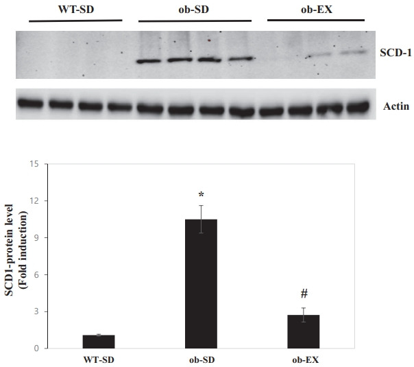 Voluntary exercise training improves body weight of leptin-deficient ob/ob mice by altering hepatic stearoyl-CoA desaturase 1 and deleted in breast cancer 1 protein levels.