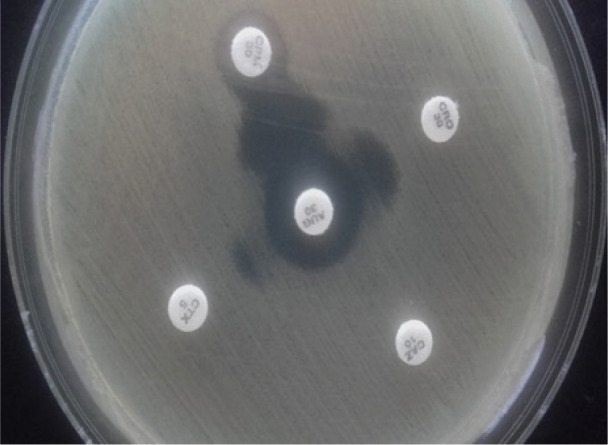 Detection and characterisation of extended-spectrum and plasmid-mediated AmpC β-lactamase produced by <i>Escherichia coli</i> isolates found at poultry farms in Bosnia and Herzegovina.