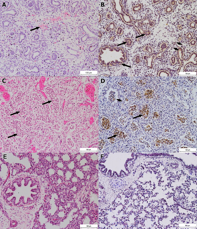 Pathological changes, distribution and detection of <i>Brucella melitensis</i> in foetuses of experimentally-infected does.