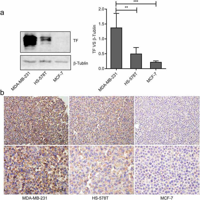 Tissue factor potentiates adherence of breast cancer cells to human umbilical vein endothelial cells under static and flow conditions.