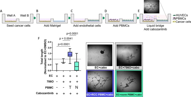 Immune cell mediated cabozantinib resistance for patients with renal cell carcinoma.