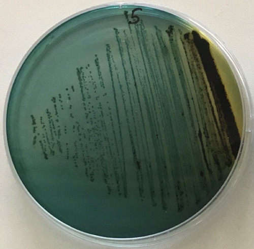 Occurrence of <i>Vibrio parahaemolyticus</i> and <i>Staphylococcus aureus</i> in seafood.