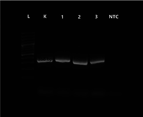 Occurrence of <i>Vibrio parahaemolyticus</i> and <i>Staphylococcus aureus</i> in seafood.