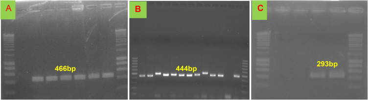 Molecular Identification of Equine Herpesvirus 1, 2, and 5 in Equids with Signs of Respiratory Disease in Central Ethiopia.