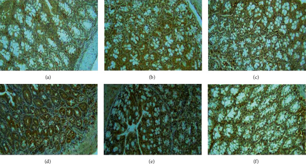 Ethanol Extract of Pomegranate (<i>Punica granatum</i>) Peel in Increasing the Expression of Caspase-3 in DSS-Induced Mice.