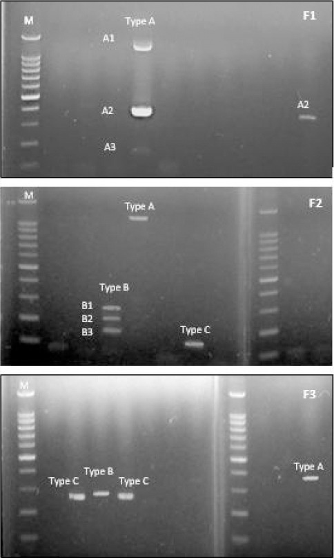 THE USE OF ARCHIVED GIEMSA-STAINED BLOOD SMEARS AND RDT FOR PCR-BASED GENOTYPING OF <i>Plasmodium</i> v<i>ivax</i> MEROZOITE SURFACE PROTEIN-1 IN CENTRAL KALIMANTAN PROVINCE, INDONESIA.