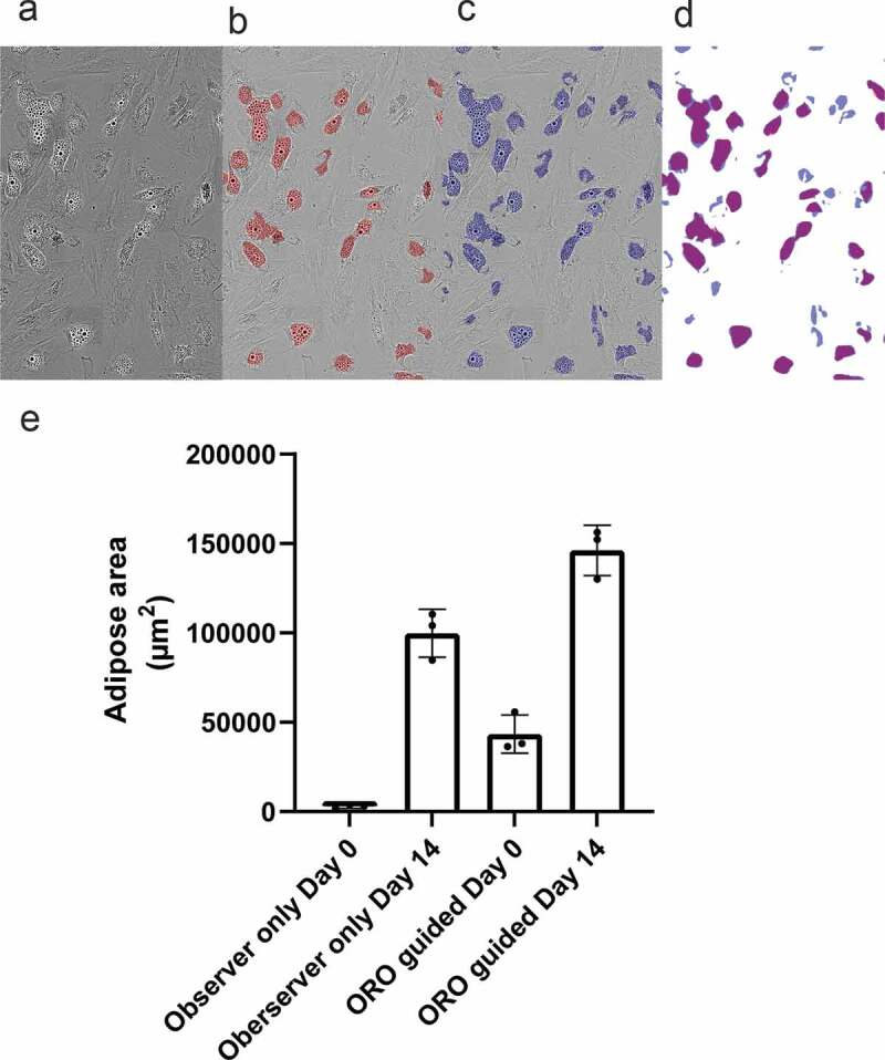 Application of a deep learning-based image analysis and live-cell imaging system for quantifying adipogenic differentiation kinetics of adipose-derived stem/stromal cells.